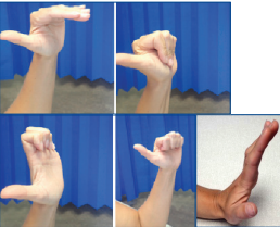 Five hand exercises