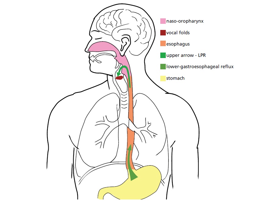 Gastro-Oesophageal Reflux