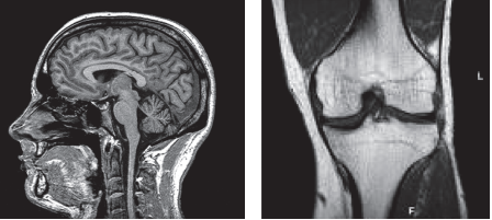 Examples of MRI scans – brain and knee joint