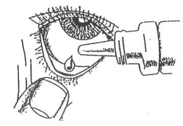 How to administer eyedrops