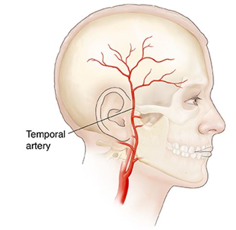 Diagram showing the temporal artery