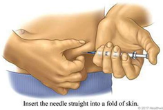 Needle insertion