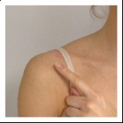Shoulder fracture location
