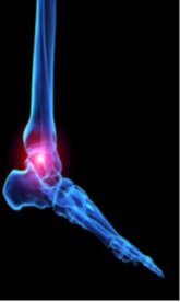 Showing an ankle joint