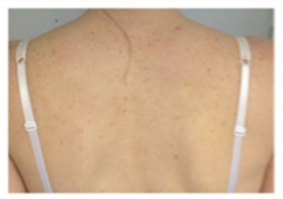shoulders back