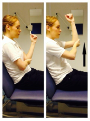 Supported arm elevation