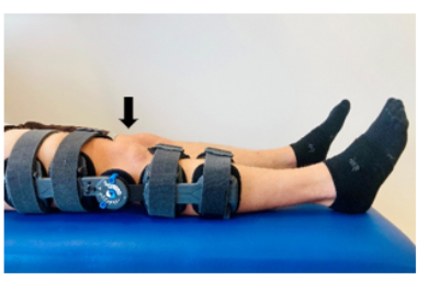 A person's legs with ankle straps 