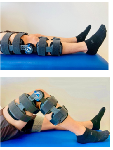 A person wearing knee brace

