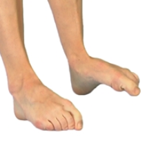 Toe Flexion and Extension