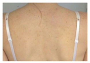 shoulders and back exercises