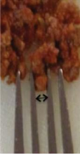 Illustration of small lumps of food passing through a fork in a 'fork test'. 