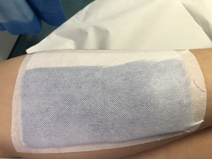 a blue gauze followed by another layer of the white Mefix dressing.  