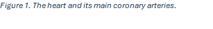 Shows a model of the heart and coronary arteries.