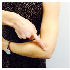 Location of elbow dislocation 