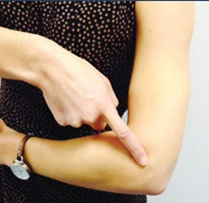 Location of elbow soft tissue injury