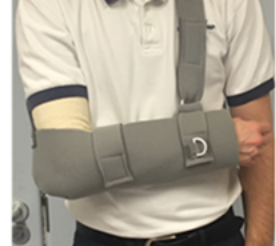 Illustration showing the correct way to wear your sling.