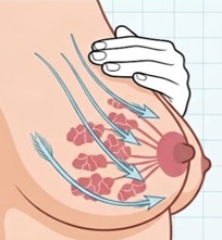 Stroking massage lightly stroke from the chest wall towards the nipple.